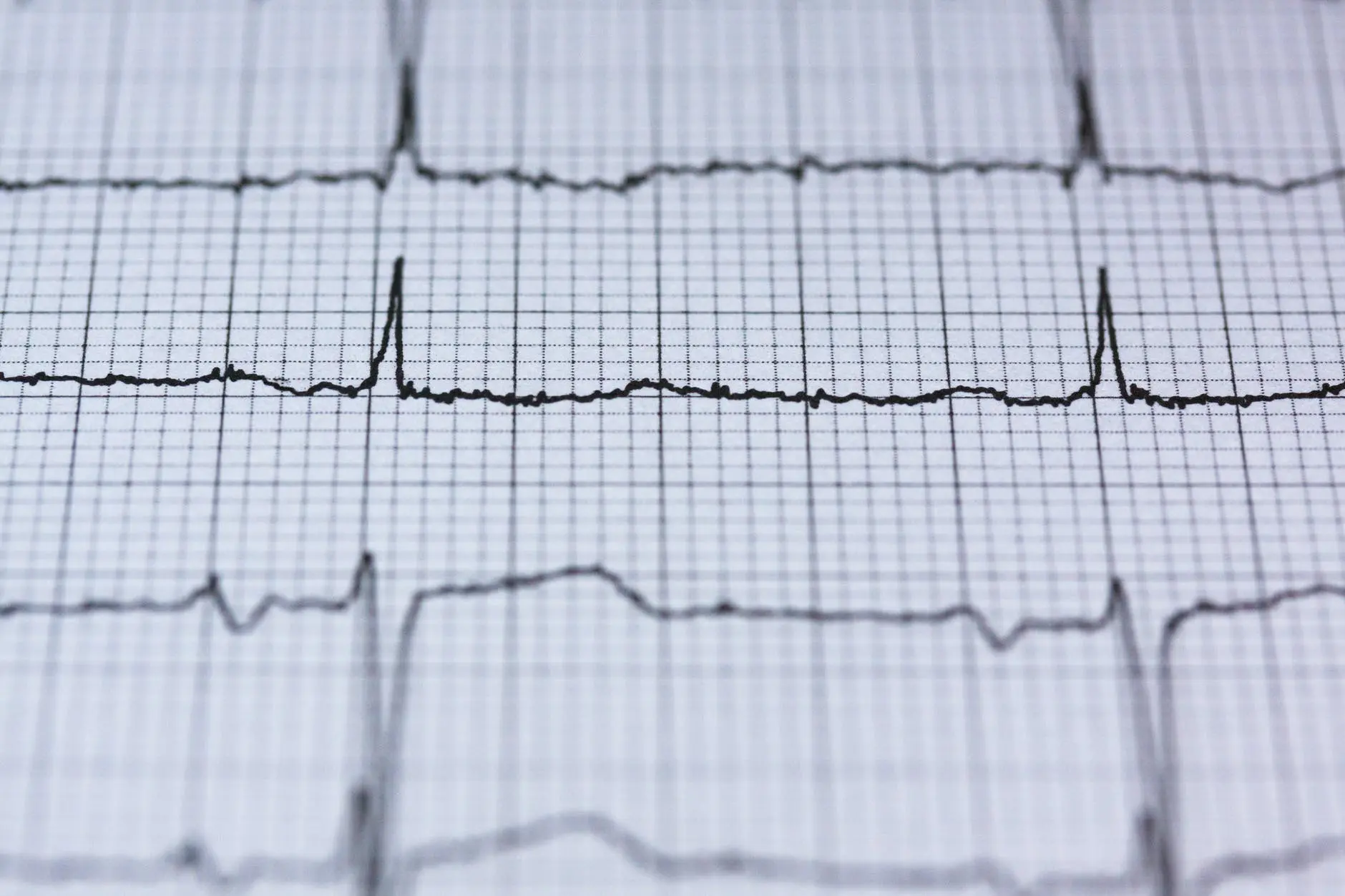 Fast Heartbeat