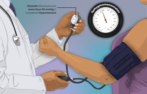 Hypertension Symptoms