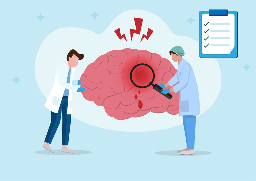 TBI Symptoms - Modafinil.org TBI Symptoms